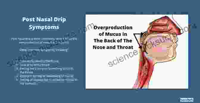 Post Nasal Drip Illustration Showing Mucus Running Down The Back Of The Throat The Peanut Allergy Epidemic Third Edition: What S Causing It And How To Stop It